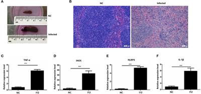 MicroRNA-21 Mediates the Inhibiting Effect of Praziquantel on NLRP3 Inflammasome in Schistosoma japonicum Infection